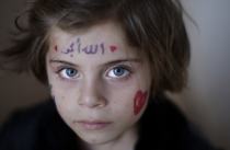 Aya Abdulhay, 5, de Alepo está refugiada en Azaz,, Turquía. (AP / Muhammed Muheisen)